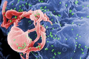 두 번째 HIV 환자, 극히 드문 경우지만 자연치유 됐을 것이라는 가능성